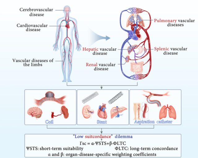 High Suitcordance for Panvascular Full-Watershed Organs article