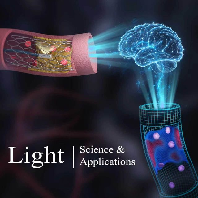 Light: Science & Applications, Intelligent Photonics and Digital Twins in Panvascular Disease